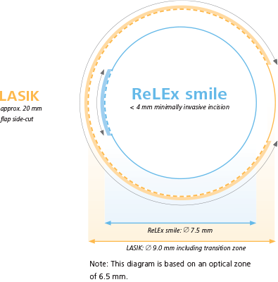 Image Of Relex Smile